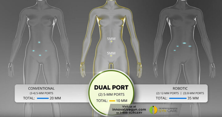 DualPortGYN diagram