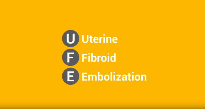 Uterine Fibroid Embolization